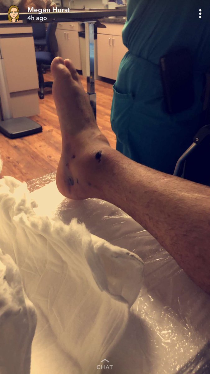 craigg107's tweet photo. Surgery went well this morning and I can’t thank everyone that helped and checked on me today. Going to be a long road of recovery but I’m beyond ready. I can’t thank @megan225hurst  enough for coming this morning and staying all day laying up with me. Beyond blessed. https://t.co/abBBmdGQv5
