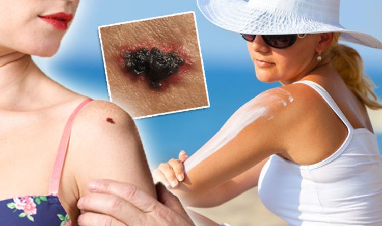 AltruistSun's tweet photo. Skin cancer: 4 ways to prevent the UK’s most common cancer.
#skincancer kills 7 people in the UK everyday, but is largely preventable. Great @dailyexpressuk article on how to prevent sun damage and reduce risk 👇#TuesdayThoughts #sunfactor @BSFcharity https://t.co/FtYggTm97l https://t.co/X7VCsmTSPW