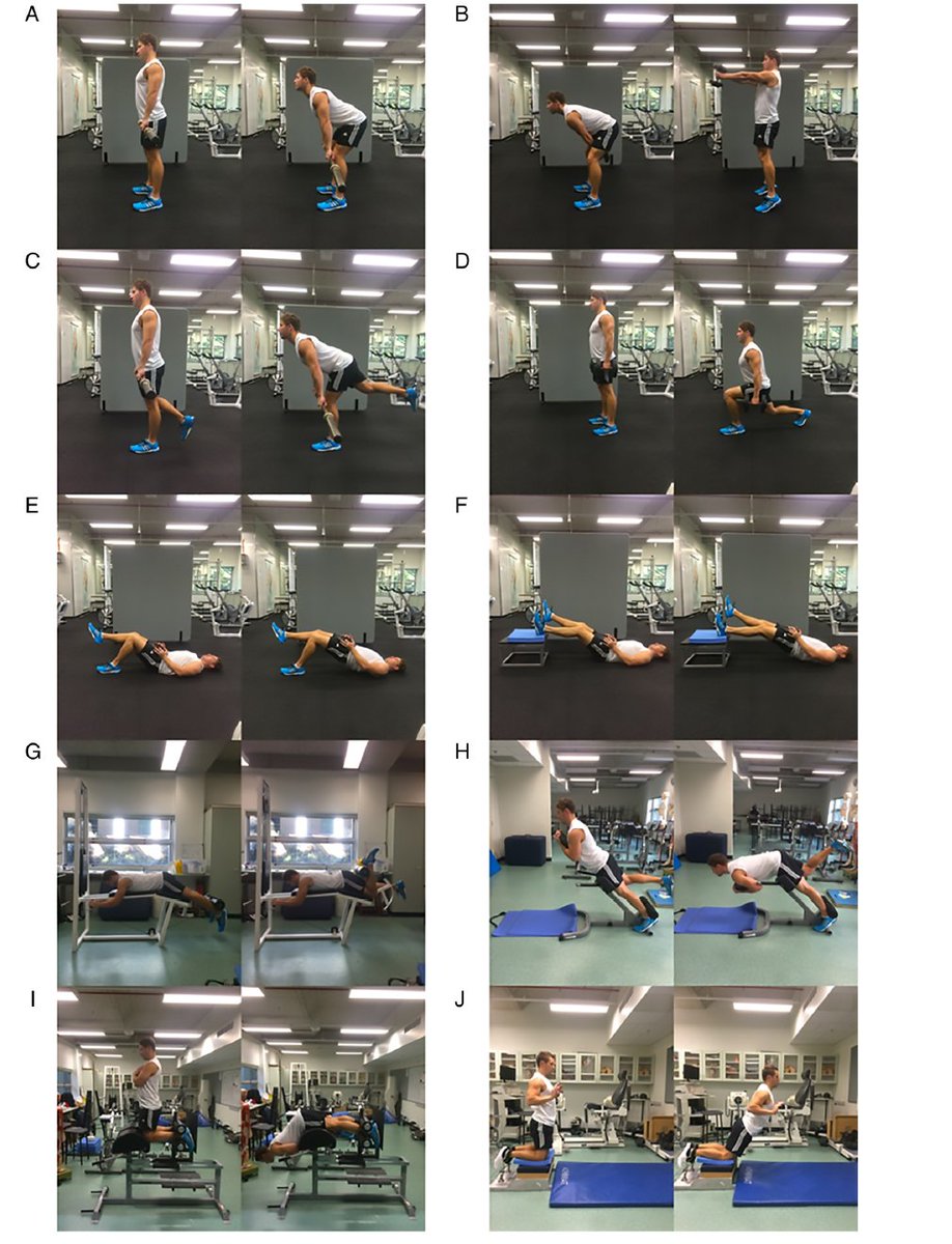 Exercise selection on hamstring muscle activation: "During ecc actions, hip-extension exercise ⬆️ lateral hamstrings (hamstrings injuries❗️) while knee flexion-oriented exercises preferentially recruit ⬆️ the medial hamstrings (ACL❗️)
bjsm.bmj.com/content/early/…