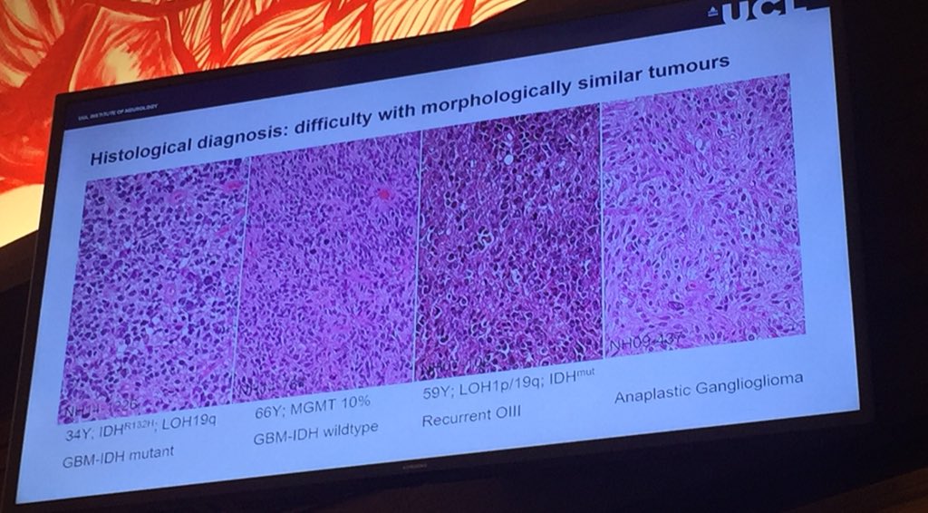 mtvc2's tweet image. Testing our histological diagnosis skills with @Seb_Brandner at @EU_Brain #BrainMissionFP9