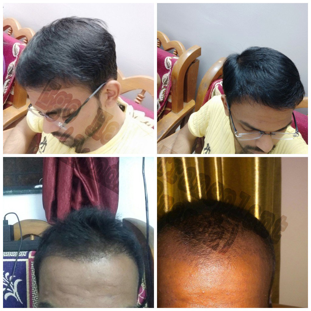 تويتر \ Mallia & Derma على تويتر: تويتر \ Mallia & Derma على تويتر: