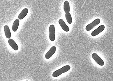 lu_jess028's tweet photo. the accidental importaron of harmful diseases and funguses from other places.... sounds familiar, and its killing bats :( #psychrophile #6thextinction #ees028 https://t.co/9v5iFzf1cP