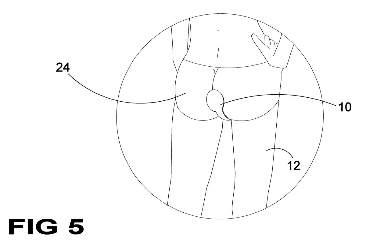 rob_marin's tweet photo. @SethBruneel @yost7 You guys in the market for a "Flatulence deodorizer US6313371B1?"

#stupidpatents https://t.co/wV48DNxhEB