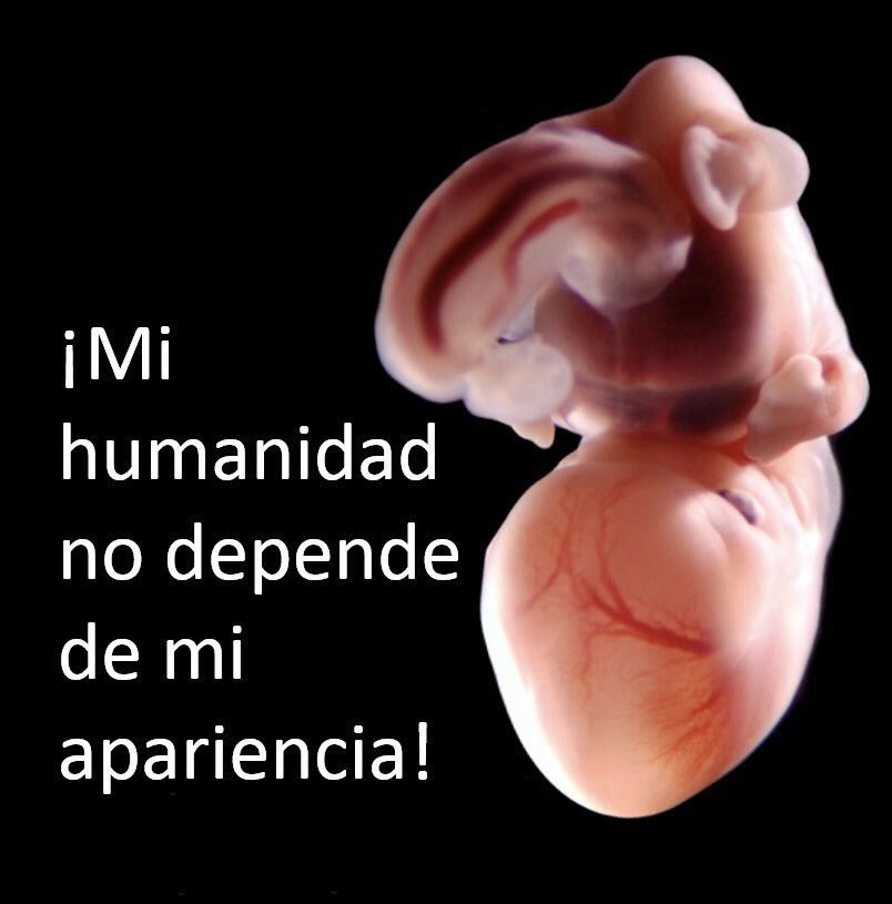 MaElena06's tweet photo. Me dan pretextos para decidir qué no tengo voz y #SiCuento Por eso #MiVotoDefiendeLaVida y estoy encontra de leyes que no protegen mi derecho a la #Vida @SCJN y @CNDH me abandona espero tu No @partidoverdemex @AccionNacional @PRI_Nacional @MovCiudadanoMX @PRDMexico @ALDFmorena https://t.co/OJWZ7FkoZN