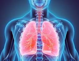 CrnicInstitute's tweet photo. Ever heard of pulmonary hemosiderosis before? It's very rare, but this group just found that children with Down syndrome account for ~20-25% of all cases. Wow! https://t.co/Tbuv5J79UQ
#LungDisease #OrphanDisease #Pulmonology #DownSyndrome #DSresearch #Autoimmunty #Autoantibodies https://t.co/vAqSGEph9B