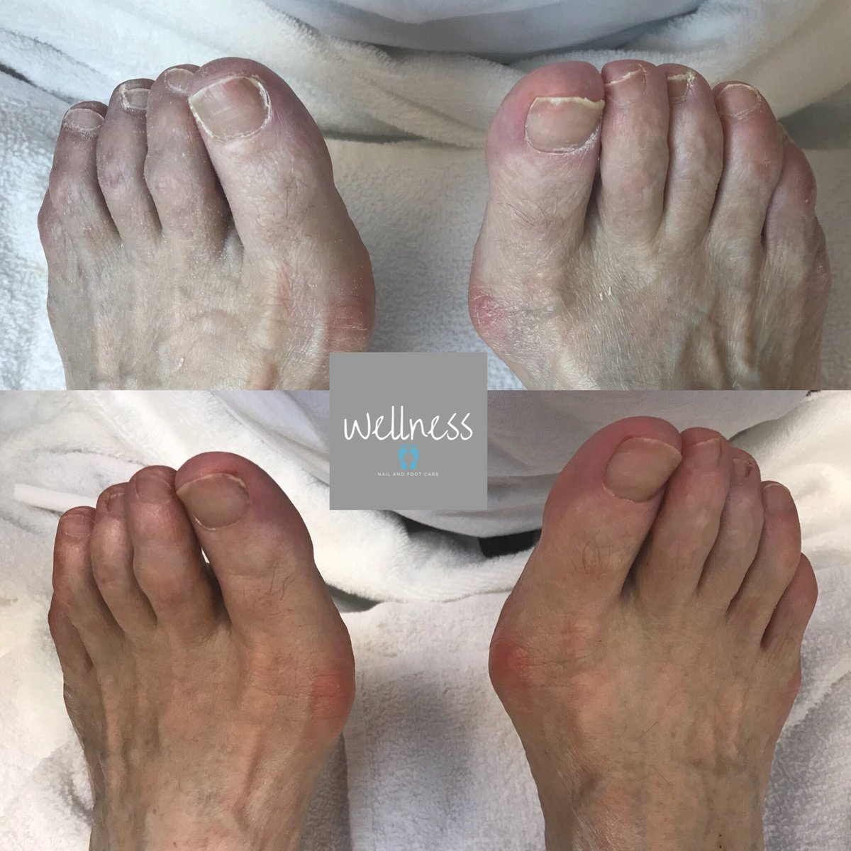 WellnessFoot tweet picture