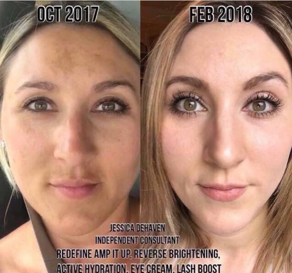 RFlovesyourskin's tweet photo. Loving these results! Yes - you can have great skin and lashes too!!!
Ask me how to get 10% off and Free Shipping KeepCalmAndLoveYourSkin@gmail.com
#thickerdarkerlongerlookinglashes #antiaging #sundamage #guaranteedresults https://t.co/sYTDMwaQXS