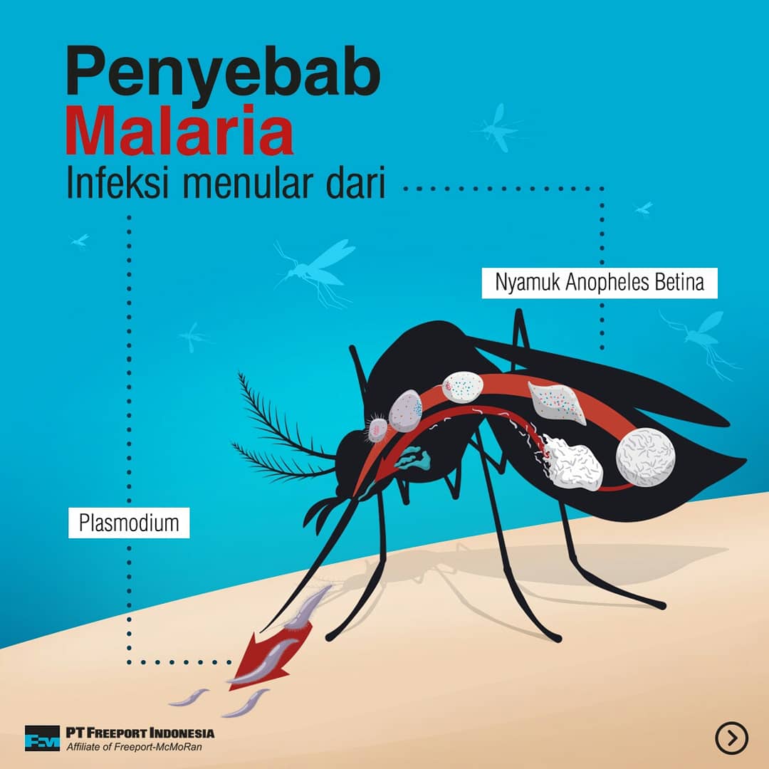 Freeport Indonesia On Twitter Malaria Merupaka Penyakit Infeksi Menular Yang Disebabkan Oleh Plasmodium Dan Ditularkan Oleh Nyamuk Anopheles Betina Yang Dapat Menyebabkan Kesakitan Bahkan Kematian Untuk Semua Usia Https T Co Fvru1i7izs Twitter