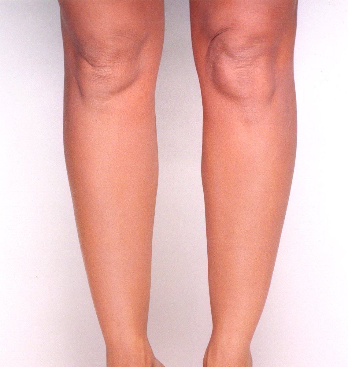 CovermarkUK's tweet photo. Our Leg Magic, perfectly conceals any blemish or imperfection on the legs and body, such as varicose veins, stretch marks, phlebitis, vitiligo, scars &amp; burns, dark marks, sun spots, moles, bruises and tattoos 💜 PLUS WE HAVE AN AMAZING 20% OFF ⭐ https://t.co/l6tsivfC8D https://t.co/fKKjmwTa6r
