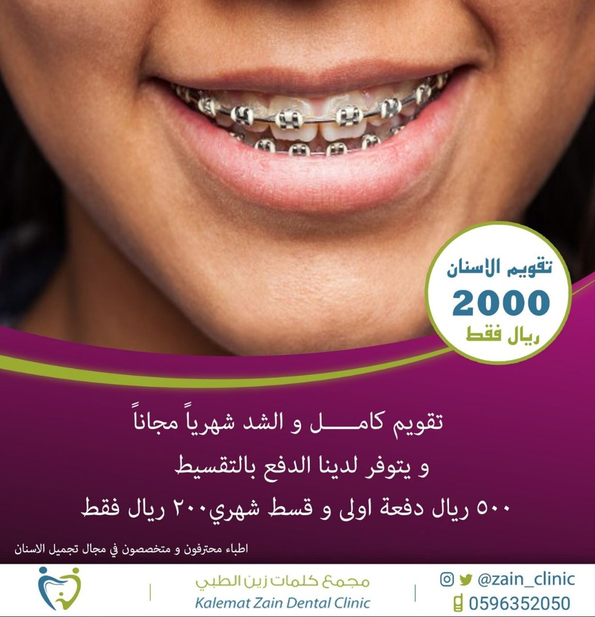 مجمع كلمات الطبي On Twitter ورينا ابتسامتك والحين مع مجمع كلمات زين الطبي تقويم اسنان كامل بسعر خيالي وكمان تقدر تقسط لفترة محدودة للحجز والاستفسار 0596352050 الرياض مخرج 30 تقويم اسنان تقويم اسنان تجميل نساء