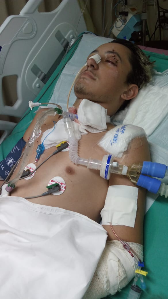 Mtzinbfr's tweet photo. Quando paro pra pensar q fiquei 3 meses no hospital internado e durante esses 3 meses 1 foi em coma  por conta do meu acidente, meus olhos enche lágrima,todo dia eu agradeço a Deus pela nova oportunidade de vida q ele deu , só tenho a agradecer muitíssimo a Deus ,piores 3 meses🙏 https://t.co/OGQZhCJ4WK