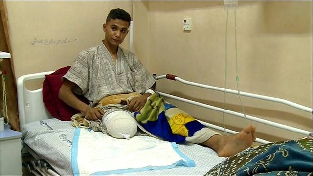 BDSmovement's tweet photo. Doctors Without Borders says it has treated more Palestinian patients this month than in the whole of 2014 when Israel invaded Gaza. Demonstrators shot by Israeli soldiers are suffering “devastating injuries of unusual severity” #StopArmingIsrael https://t.co/exVk465RXl https://t.co/AAH7nJY9yH
