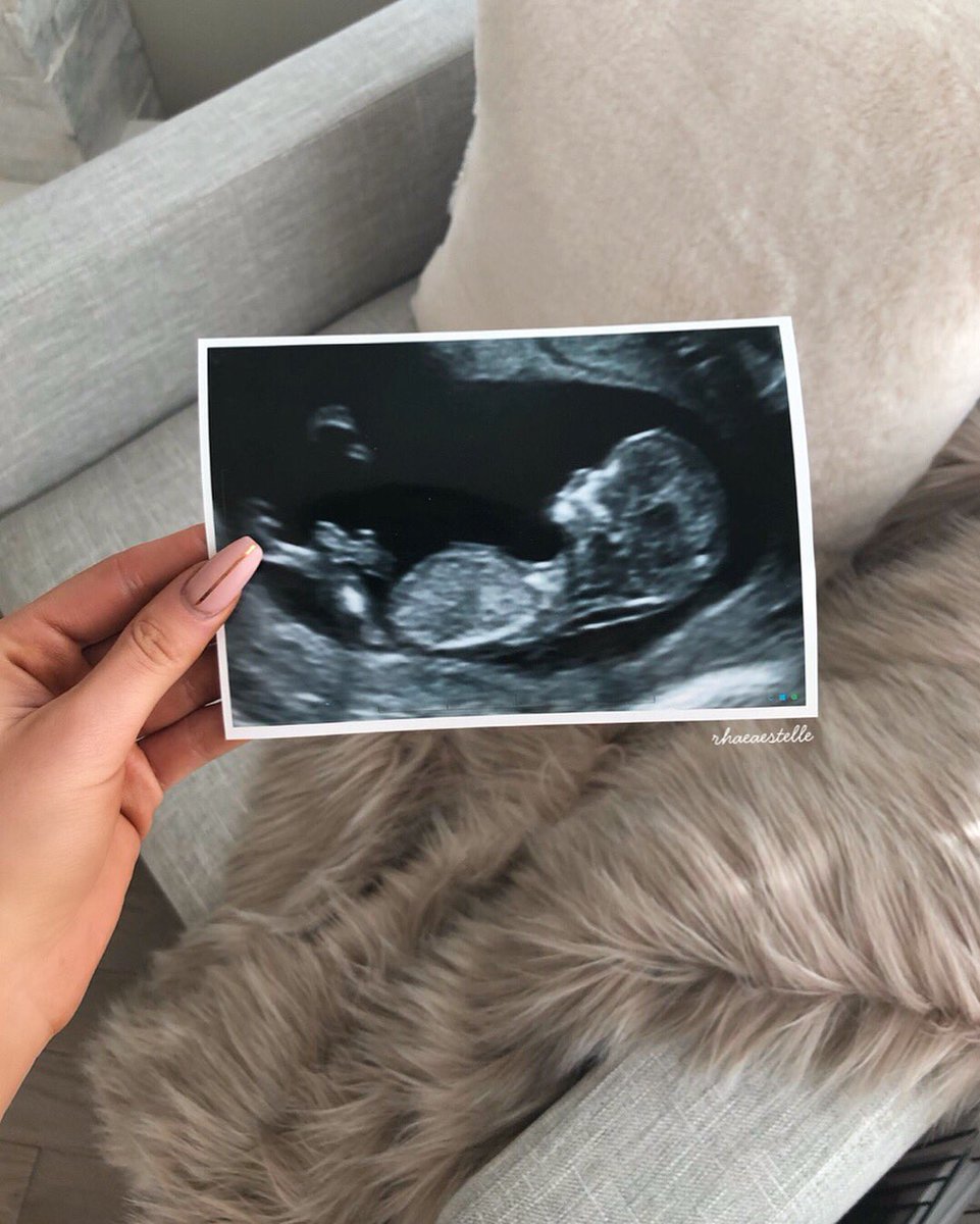 RhaeaEstelle's tweet photo. Forgot to post this here yesterday SO here it is for those of you who haven’t seen it 😊 we are over the moon about our little babe coming in September !  💛 #17weeks https://t.co/RS9vzabYVI