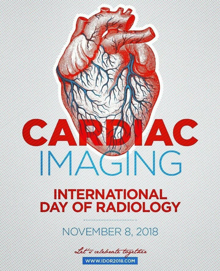 IagoMtnezSouto's tweet photo. Hoy durante #Revolutionday tendremos el placer de contar con el prof Gianluca Pontone, para hablarnos, como no podía ser de otra manera, de #cardioTC os dejo un vídeo de una d sus últimas visitas a Madrid https://t.co/liV9MaDWIK #radiologia #TC #RevolutionCT #idor2018 https://t.co/P1RTUusbqu