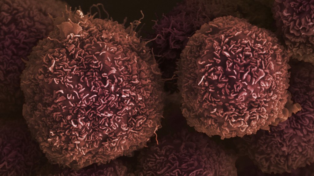 CR_UK's tweet photo. How does cancer start? Our new #ScienceSurgery post explains: https://t.co/h75DlvlmWW https://t.co/uIFM65MBsb