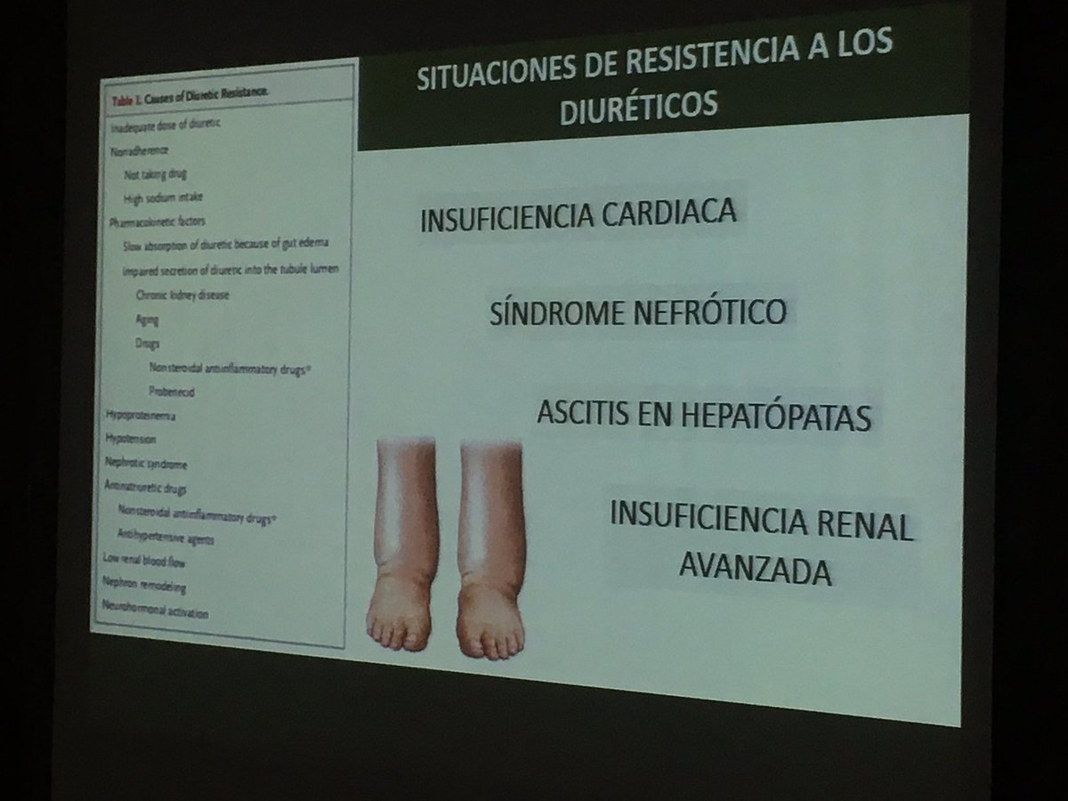 beaff26's tweet photo. Resistencia a diuréticos, pasar a Iv, añadir diurético distal @ralcazara @senjoven @SENefrologia @FJDNefrologia #VIIICursoAvancesenNefrologia https://t.co/tZwsf9I5Qi