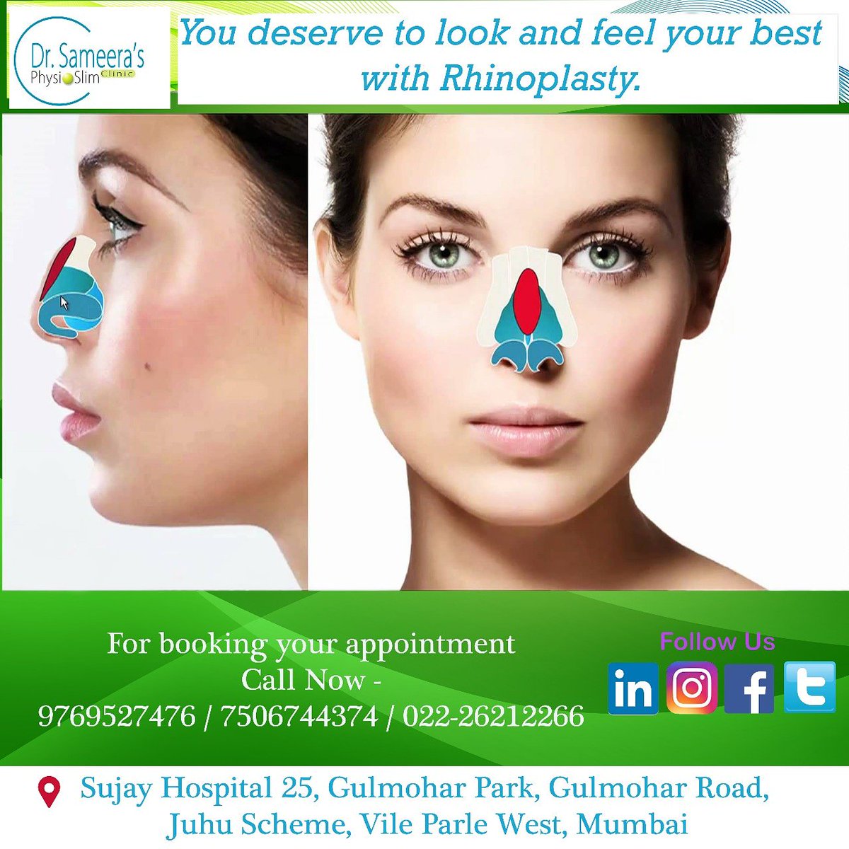 DrSameeraPhysio's tweet image. #CosmeticSurgery  for #perfectnose Using #latesttechniques in #Rhinoplasty done by #experienceddoctors @DrSameerasPhysioslimClinic #Beauty is not just the privilege of a few. Each woman has OPTIONS to look naturally beautiful
Book your appointment Now
Call 9769527476 /7506744374