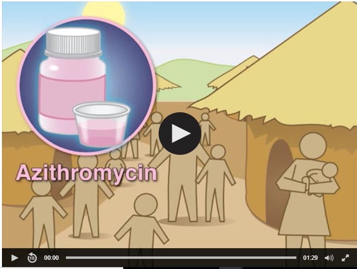 NTDResearch's tweet photo. Exciting new #NTDs research in @NEJM: #Trachoma MDA with Azithromycin
could save children’s lives! https://t.co/gjZl1tlBr9
Research collab w.@LSHTM  @UCSF @Pfizer @GatesFoundation @CarterCenter @JohnsHopkins  @ITIatlanta @TFGH @NIMRHQS #beatNTDs https://t.co/LzwsA8dWta
