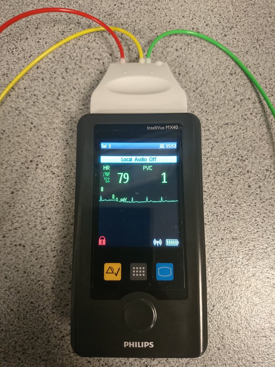 Newly launched telemetry units allow for monitoring at point of care #hairmyresandproud #teamcardiologyuhh