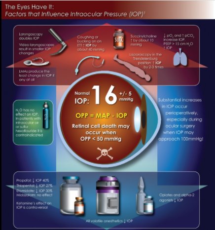May 2018 Infographic: The Eyes Have It: Factors that Influence Intraocular Pressure (IOP) goo.gl/Y2vs5V