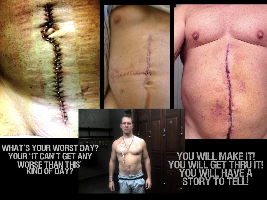 Scatterbrain321's tweet image. If you haven't listened to our first podcast- do it! It's about overcoming! It's called "Whats it take to be a man"!