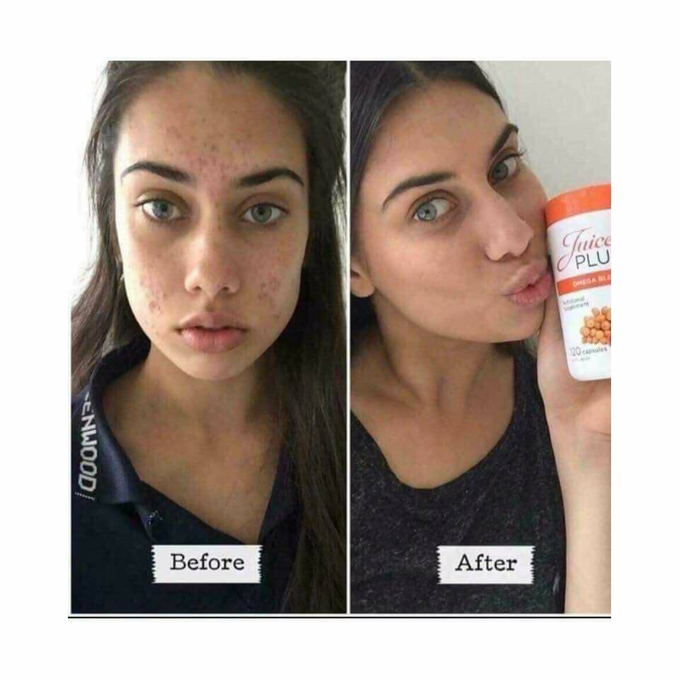 96laurawells's tweet photo. What could you achieve in 90 days? 
😀 Beautiful skin 😀 Toned body
😀 Weight loss 😀 More energy
😀 Looking amazing 😀Feeling amazing
This is a perfect time! Summer is approaching!
Get yourself holiday ready! 😀
Plans to suit your needs and budgets! 😙 
 #summerbody https://t.co/nqvuJfbDsw