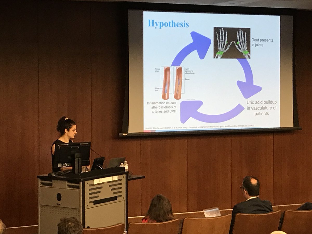 BMEIIsinai's tweet photo. Cardiovascular session selected abstract #TMII2018 Sharon Barazani showing how to use #DECT to detect uric acid buildup and vasculature in gout https://t.co/rEY88zX7la