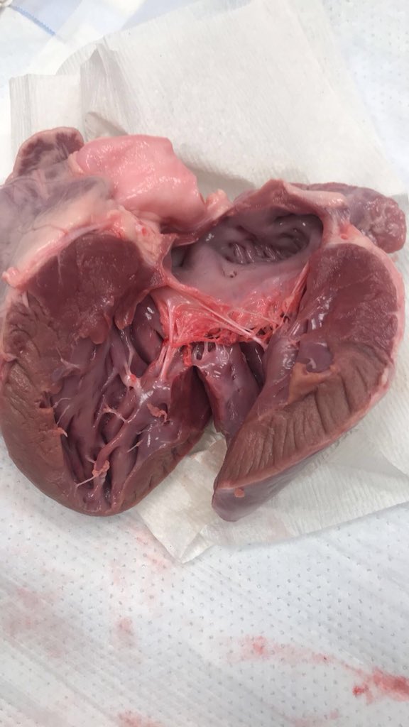 David L. Fischman (@fischman_david) on Twitter photo Long-standing tradition <a href="/TJUHospital/">Jefferson Health</a> on #BringYourChildToWorkDay Dissecting pig hearts. Beats just watching dad work. <a href="/DocSavageTJU/">Michael Savage</a> <a href="/GingerRT215/">Marguerite Davis</a> <a href="/HeartOTXHeartMD/">John P Erwin III MD MBA MACC (#BigPoppy )</a> <a href="/JenTroia/">Jennifer Troia</a> <a href="/getwithit_jo/">Joanna</a> <a href="/MarkDeCaro84/">Mark DeCaro</a> <a href="/fischman_ariel/">Ariel Fischman</a> @AVishnevsky_MD <a href="/DavidWienerMD/">David H. Wiener, MD</a> #CardioTwitter Long-standing tradition <a href="/TJUHospital/">Jefferson Health</a> on #BringYourChildToWorkDay Dissecting pig hearts. Beats just watching dad work. <a href="/DocSavageTJU/">Michael Savage</a> <a href="/GingerRT215/">Marguerite Davis</a> <a href="/HeartOTXHeartMD/">John P Erwin III MD MBA MACC (#BigPoppy )</a> <a href="/JenTroia/">Jennifer Troia</a> <a href="/getwithit_jo/">Joanna</a> <a href="/MarkDeCaro84/">Mark DeCaro</a> <a href="/fischman_ariel/">Ariel Fischman</a> @AVishnevsky_MD <a href="/DavidWienerMD/">David H. Wiener, MD</a> #CardioTwitter