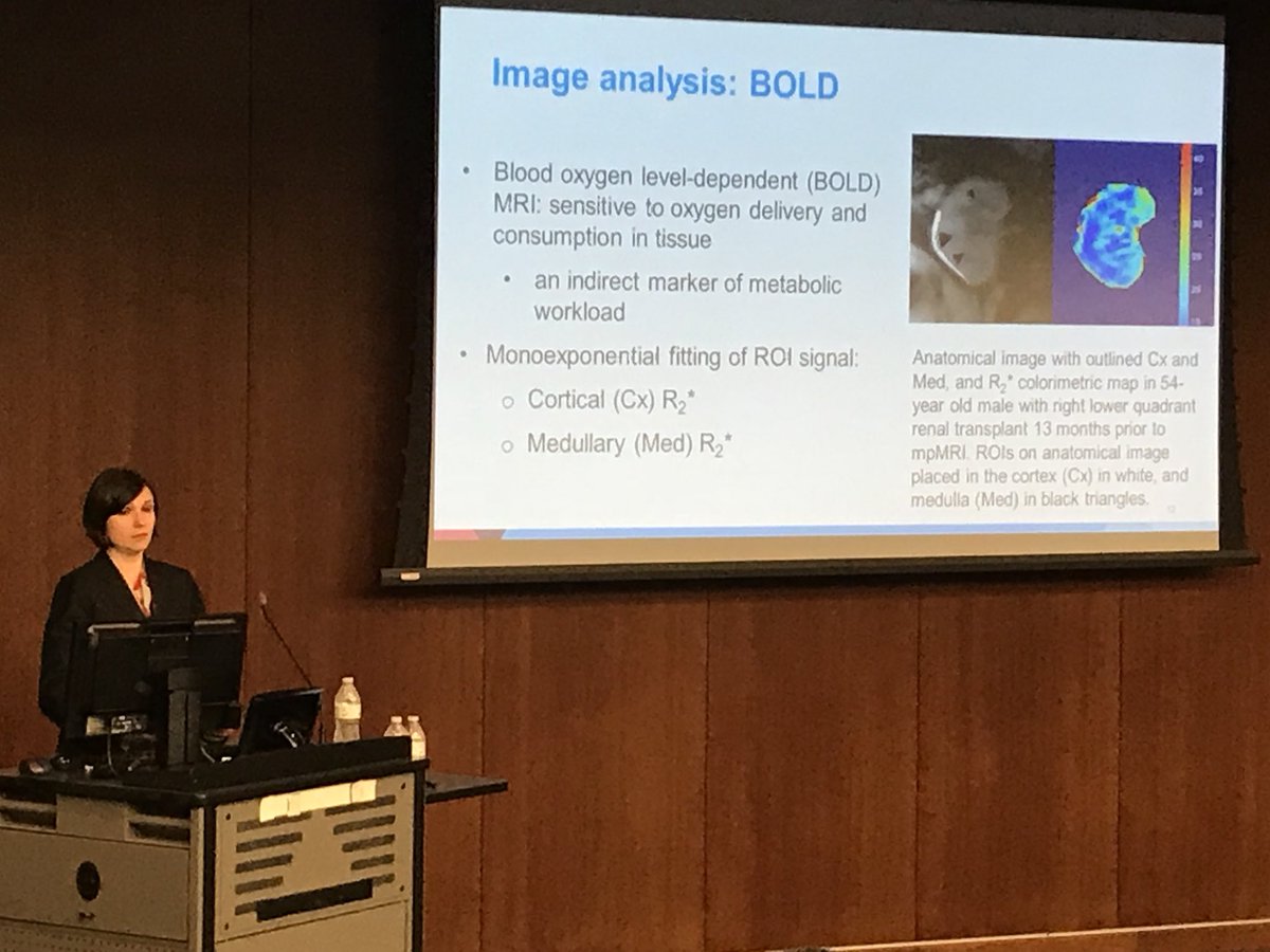 BMEIIsinai's tweet image. Octavia Bane with the last presentation from selected abstracts on #multiparametric #mri in renal transplants #TMII2018