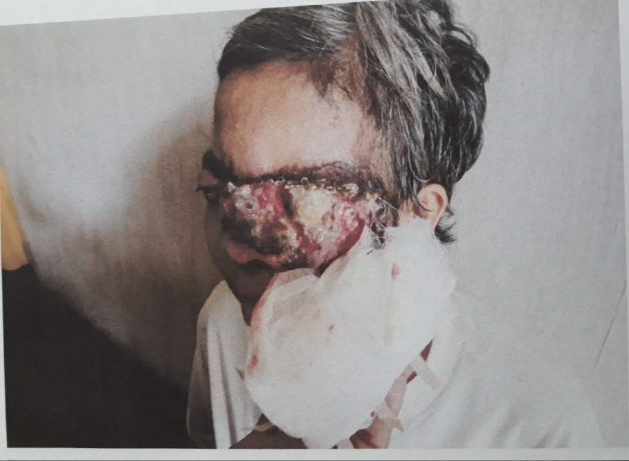 andriPAN86's tweet photo. #Jum'at #Berkah
Tim KlayaPAN membawa Ibu Patimah asal Desa Serindang Dusun Rimbun Rt,12 Kec.Tebas Kab.Sambas,yang mengalami penyakit kanker ganas kemungkinan akan di RUJUK ke RS.SOEDARSO PONTIANAK.@ZUL_Hasan
#DPDPANSambas
#GunturSPMM
#TimKLaYaPAN https://t.co/qnZv3XiXCC