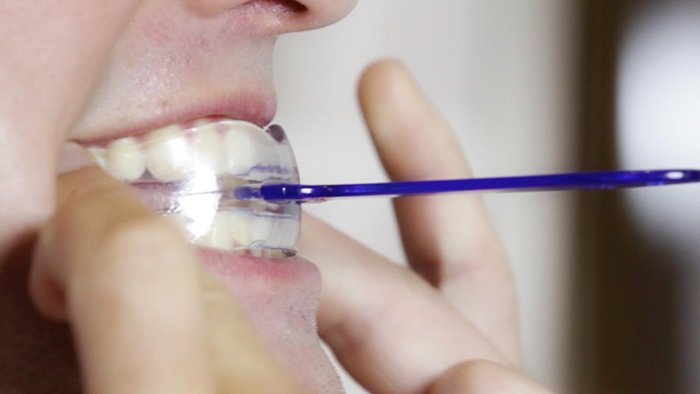 SnoringNZ's tweet photo. #SnoreMeds Review – Does This #Snoring Mouthpiece Work?
https://t.co/z8L7Wye5pf
#mouthpiece #mouthguard #stopsnoring #NewZealand #snorenomore https://t.co/7mvcdfGDmB