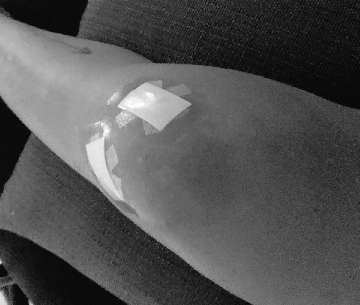 beatdown155's tweet photo. Knee done, foot next but we’re on the mend. Few months on the sidelines and I’ll be back causing havoc before you know it. Keen for the next Aussie card to give the fans a repeat of Sunday.....!
#ufc #fotn #potn #bloodbath #fightersfight #kneesurgery #nobutcher #followme https://t.co/hRfBJYMmOD