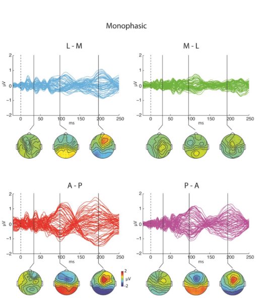 neuroraf's tweet image. TMS orientation and pulse waveform manipulation activates different neural populations: direct evidence from TMS-EEG biorxiv.org/content/early/…