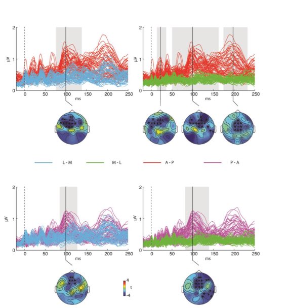 neuroraf's tweet image. TMS orientation and pulse waveform manipulation activates different neural populations: direct evidence from TMS-EEG biorxiv.org/content/early/…