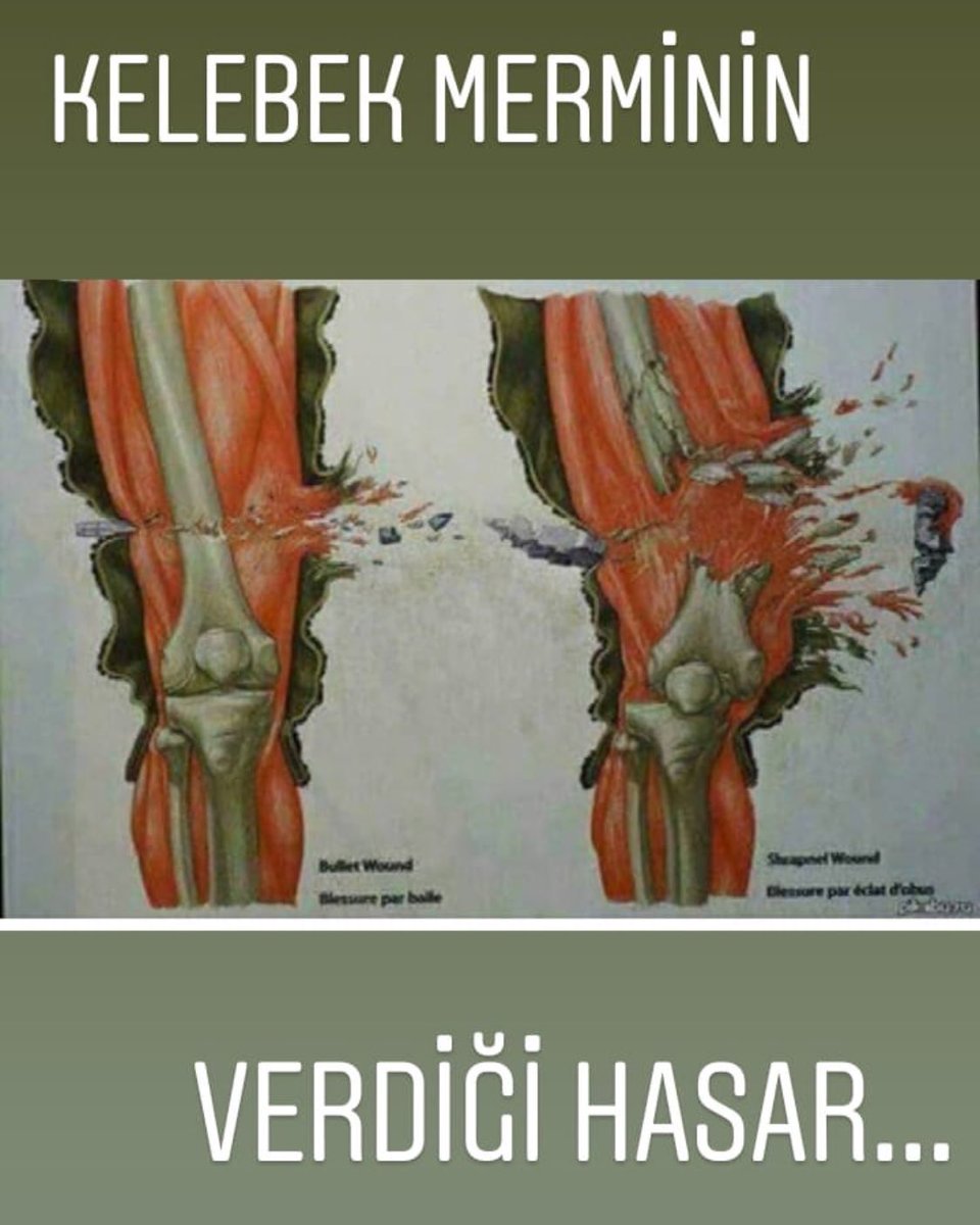 Erkeklerde Phimosis: semptomatoloji ve tedavi Erkeklerde Phimosis: semptomatoloji ve tedavi