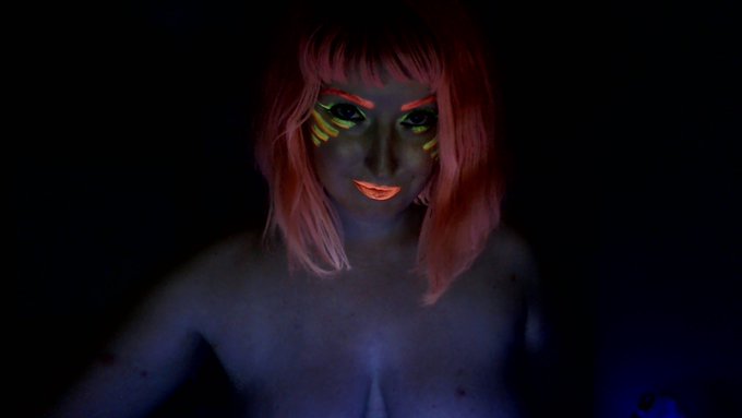 ALSO, wtf guys it looks like I got in a fight with some bug, what the heck is with all of these random