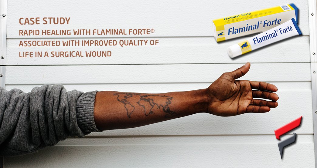 FlenHealth's tweet photo. #FlenCaseStudy | Rapid Healing with #Flaminal Forte® associated with improved quality of life in a surgical wound
Meet #FlenHealthTeam at @EWMAtweet Wound Congress in Krakow today at the booth 606.
Ask for Flaminal Forte® samples and more information.
https://t.co/jVxKpWC2kr https://t.co/n3FCHaHBE9
