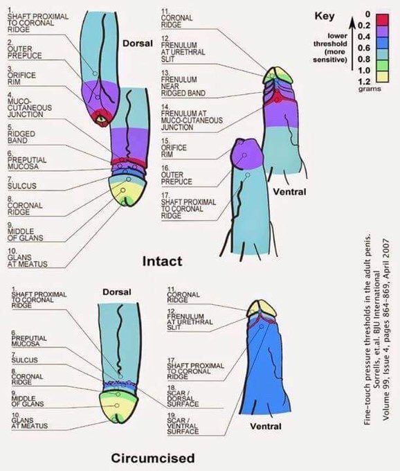 @15gunsloop <a href="/maria_delrusso/">@maria_delrusso</a> And this is on top of already having the most sensitive parts of your penis removed. (Red and purple)

Proof: Studies show that in intact men the most sensitive parts of their penises... WOULD HAVE BEEN REMOVED WITH CIRCUMCISION! 

google.com/amp/s/amp.live…