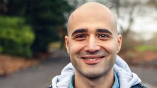 BSFcharity's tweet image. "This is a very interesting study...That said, more research will need to be done before it can be used by people with hair loss." @HealthySkin4All buff.ly/2I15PfB #hairloss #bald #baldness