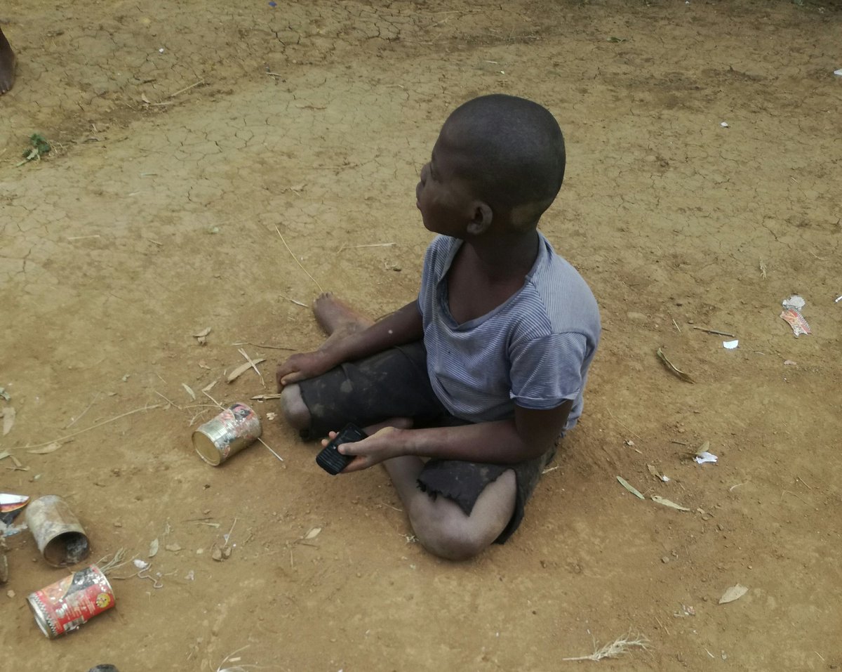 Ayanda_Bianca6's tweet photo. This is Nkosingphile my neighbour
He's 12 years of age 
He was born disabled he can't walk.
All I'm asking for him is a automatic wheelchair.. and some donation of warm winter clothes..his mother passed away..
Rt @tumisole #Countryduty https://t.co/uelJ1POtKu