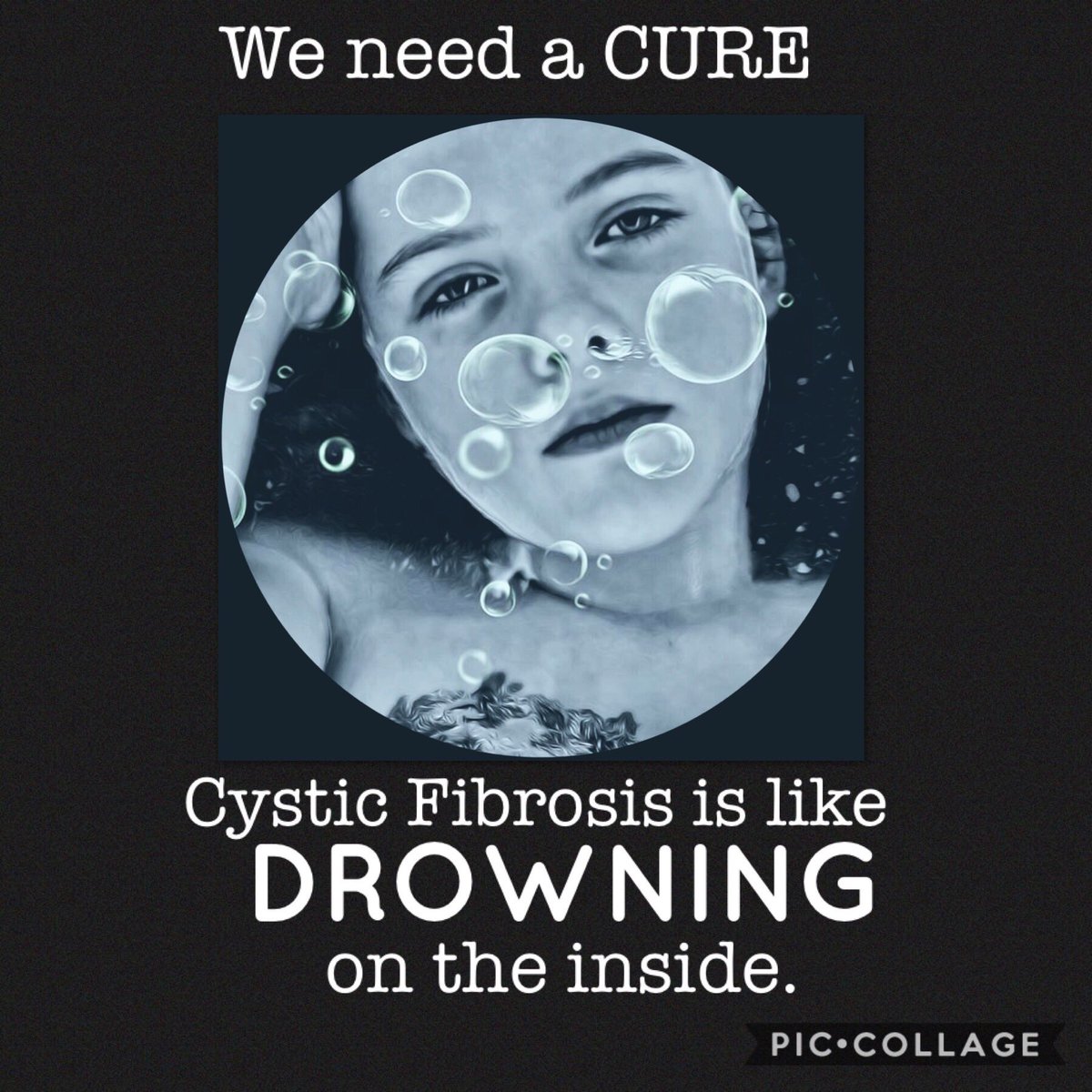 ManuelaBusack's tweet image. MAY IS CF AWARENESS!  
They say Cystic Fibrosis is like drowning on the inside.  Can you imagine that!  #cf #livingwithcf #cflife