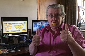 lvsd_patient's tweet photo. Inspired by the Cardiology team @NHSHighland  @pumpinghearts  @HeartyLyon @asmit03 am taking the #SuckaLemonChallenge to raise awareness of #heartfailure – for believe me it really does suck.   Text SUCK18 to 70070 to donate £3 to this fantastic charity https://t.co/YCdIJbyB9f