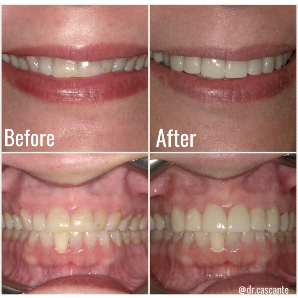 Advanced Center for Cosmetic & Implant Dentistry (drocascante) Twitter