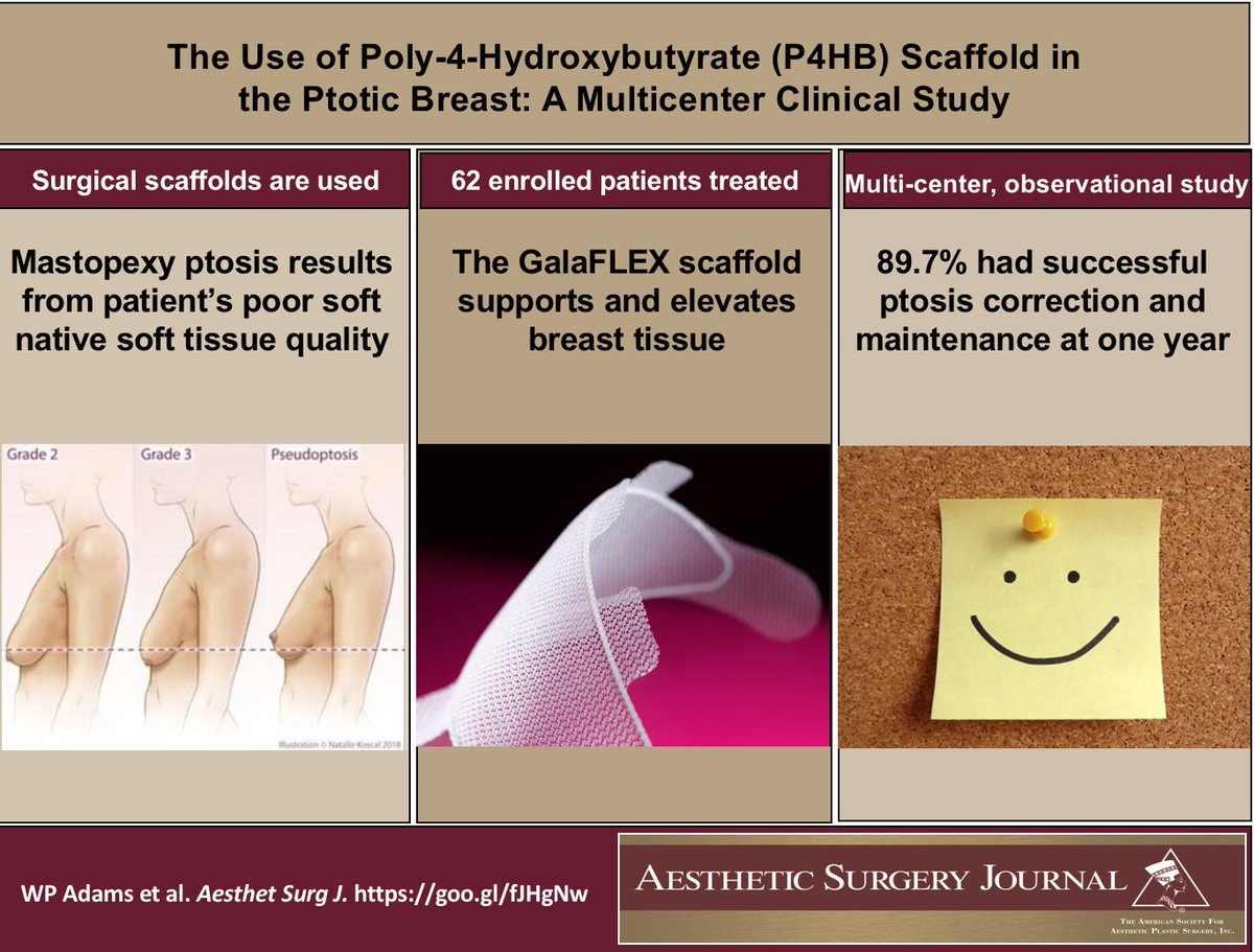 When @24hrbreastaug weighs in on #Mastopexy #Mammaplasty #Ptosis, we read! Read here: goo.gl/2VK1QG #VisualAbstract @GalateaSurgical <a href="/DrGrantStevens/">Grant Stevens, MD</a> @ASAPS <a href="/NahaiDr/">Dr Nahai</a> <a href="/jenniferrdenman/">Jennifer</a> <a href="/drroykim/">Roy Kim 🇺🇸</a> <a href="/drheatherfurnas/">Heather Furnas, MD</a> <a href="/drpacocanales/">Paco Canales</a> <a href="/Danjgould/">Dr Gould</a> @DrWinocour <a href="/clemensmd/">Mark Clemens MD MBA FACS</a>
