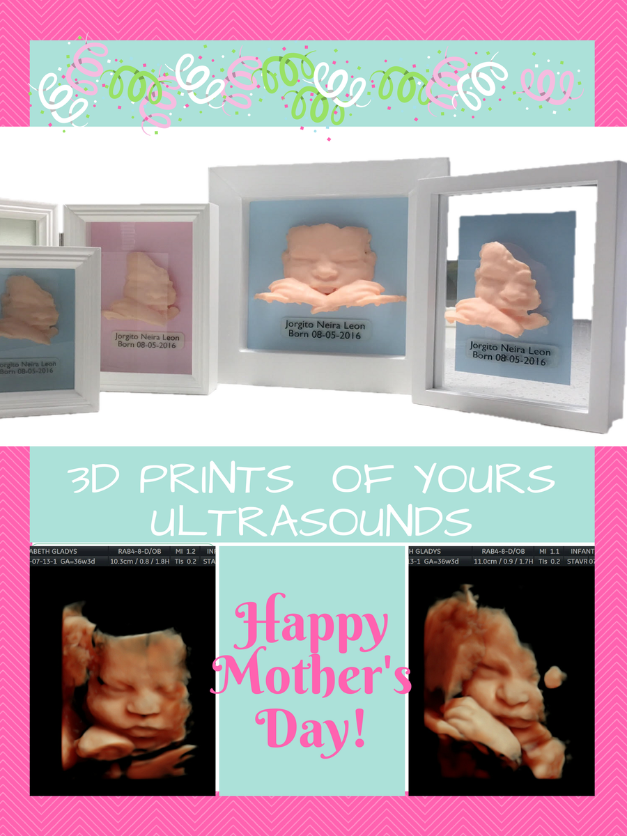 3dUSprint's tweet photo. 🌹 HAPPY MOTHER'S DAY🌹👶💕 3D PRINT OF YOUR ULTRASOUND 💕 https://t.co/tyJmHAco9e