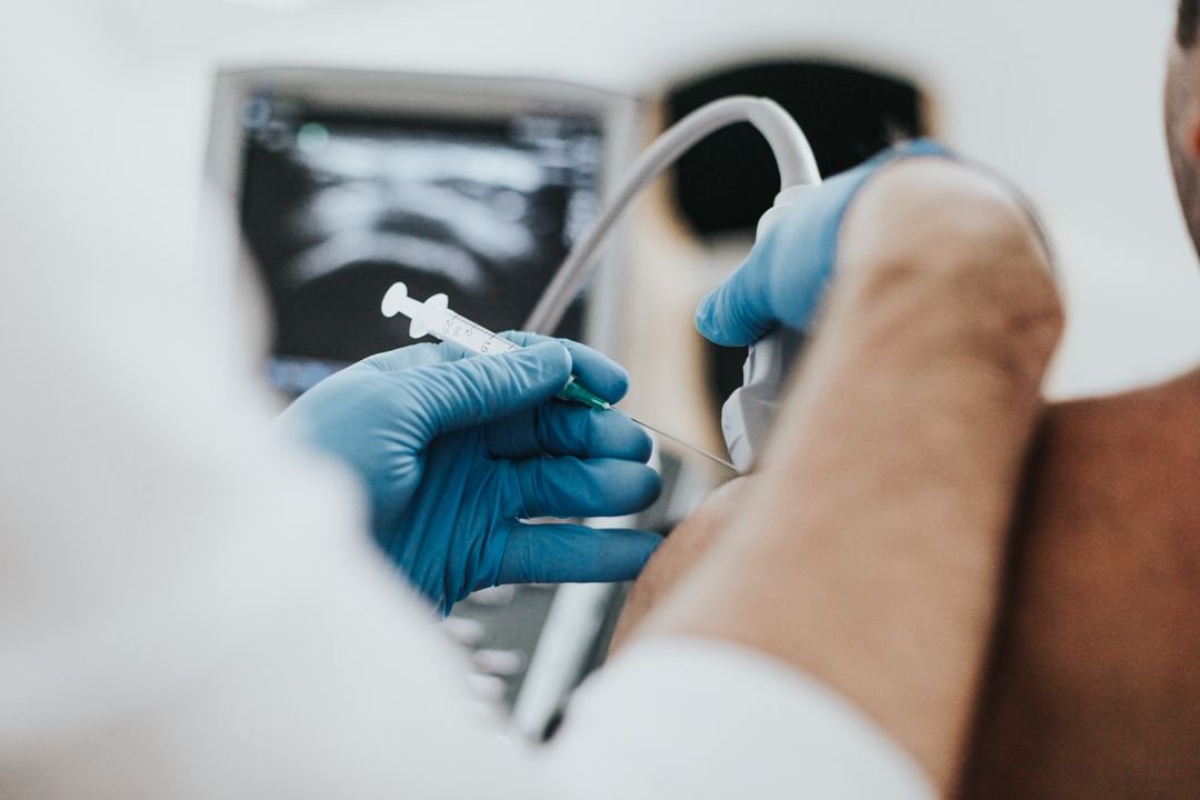 <a href="/CompletePhysio/">Complete Physio</a> we perform all our injections under ultrasound guidance - Why ? To confirm diagnosis, to improve accuracy, to improve treatment outcomes, to reduce risk of any local tissue trauma and to reduce risk of local side affects.