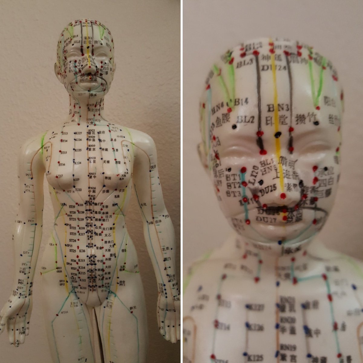 Acupuncture facial meridians tit
