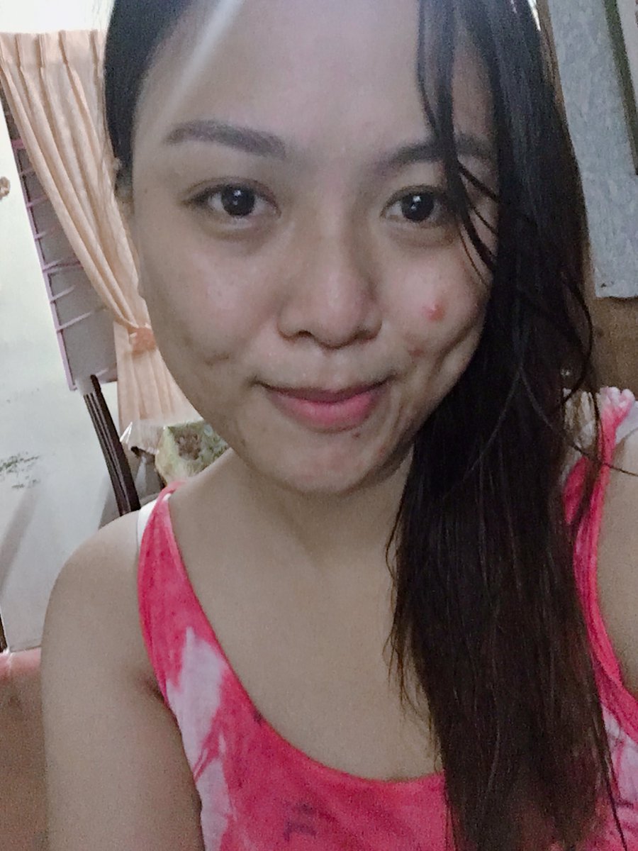kneekahness's tweet image. When they’re always there and never leave you. 😂

#simplepimple😅 #afterworkoutselfie🤸🏻‍♀️