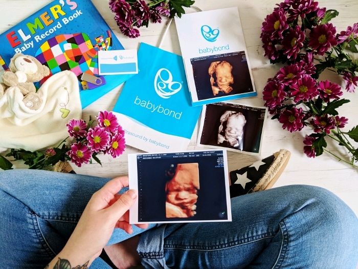 Illustrated Teacup: What to expect from a 4D scan buff.ly/2KNkngu

Review with @USDSWCOAST 

<a href="/mummy_bloggers/">Mummy Bloggers</a> <a href="/wemadeababyblog/">We Made a Baby</a>  #mblogchat #wmabchat