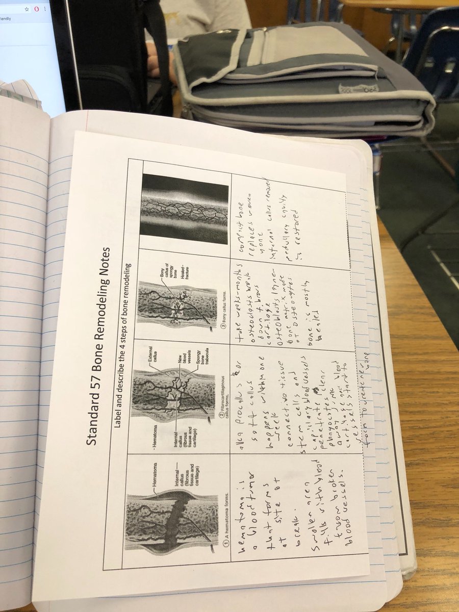 Vincent_Bio's tweet photo. #RHSBMS Bone notes https://t.co/zovOuu73zZ